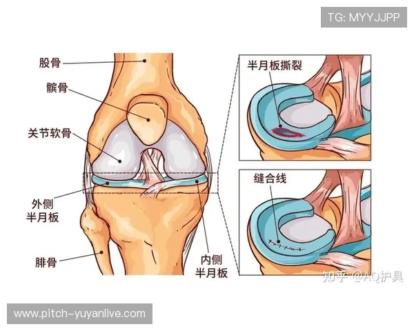 足球球星频繁遭遇半月板损伤的原因及其对职业生涯的影响分析